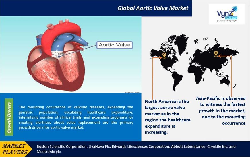 Aortic Valve Market Highlights