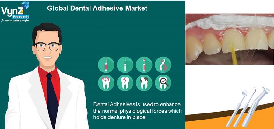 Dental Adhesive Market Highlights