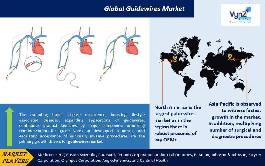 Guidewires Market Highlights