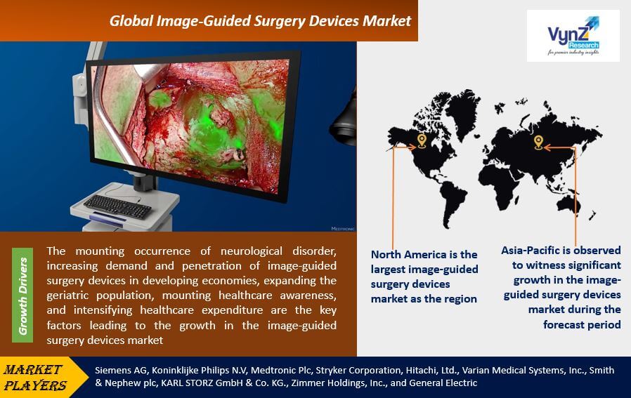 Image Guided Surgery Devices Market Highlights