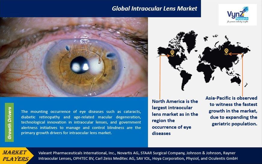 Intraocular Lens Market Highlights