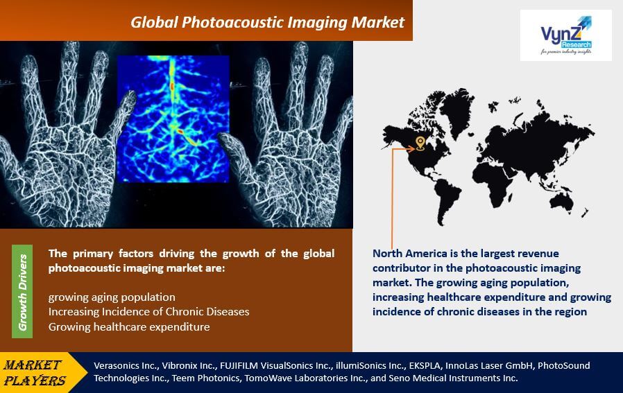 Photoacoustic Imaging Market Highlights