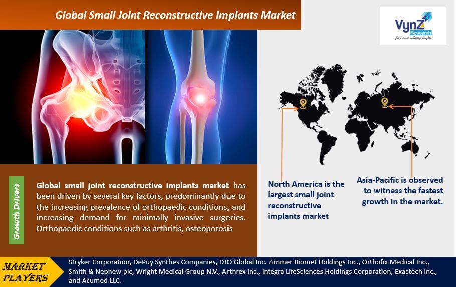 Small Joint Reconstructive Implants Market Highlights