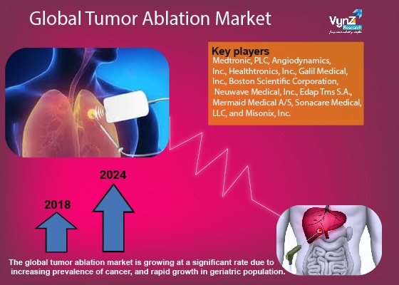 Tumor Ablation Market Highlights Tumor Ablation Market Highlights